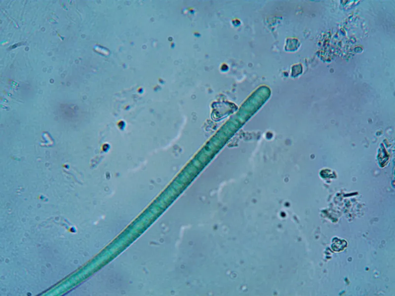 Vida microscópica al rescate: cómo las bacterias están devolviendo la salud a los ríos y lagos de América Latina